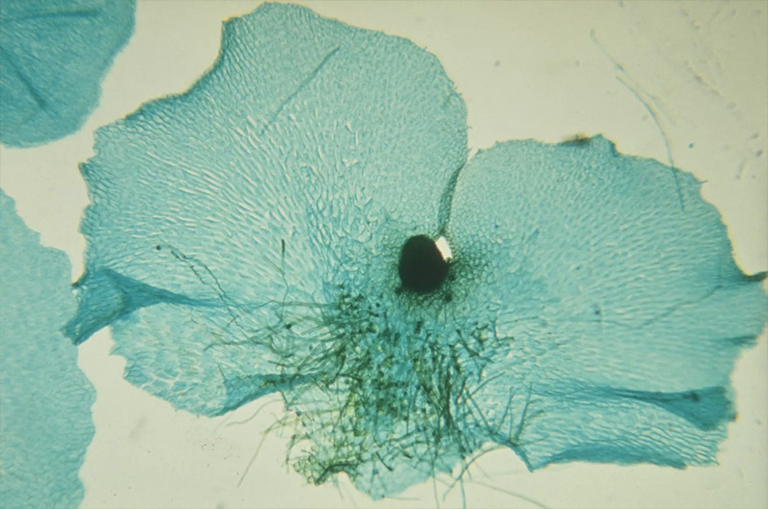 蕨類植物Prothallia.jpg 蕨類植物Prothallia